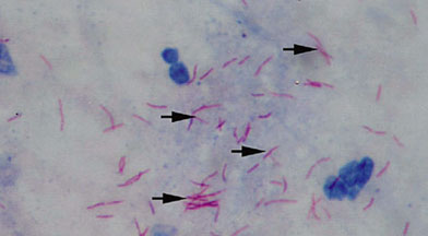 RRH: Rural and Remote Health article: 791 - Health status of Sahariya ...